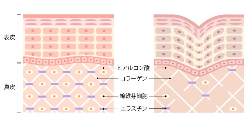 皮膚の断面解説図(イメージ画像)
